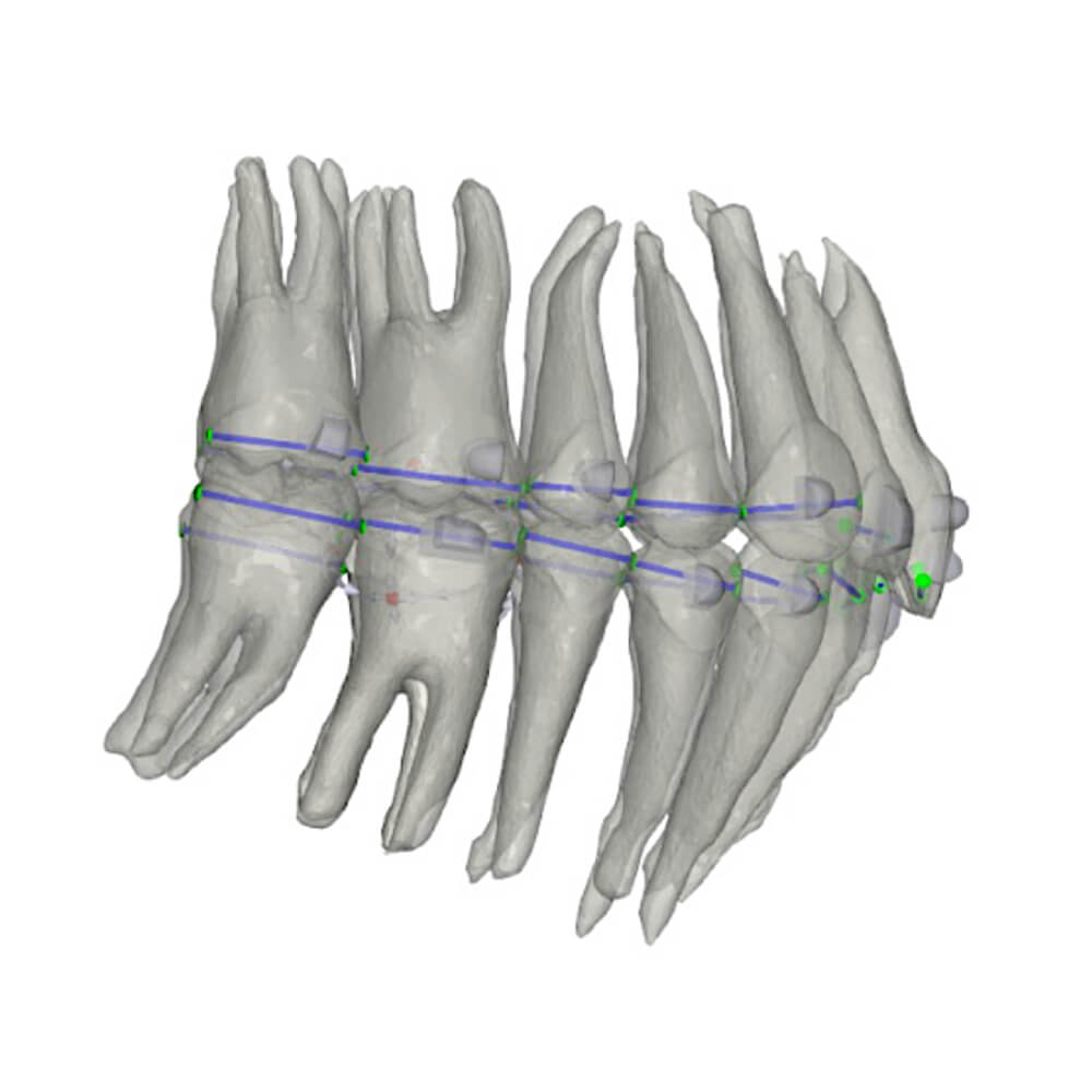 FAS Aligner System - FAS Occusal Design