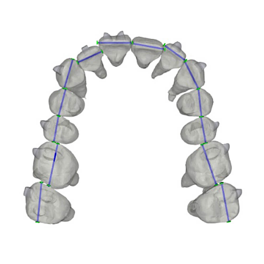 FAS Aligner System - FAS Occusal Design