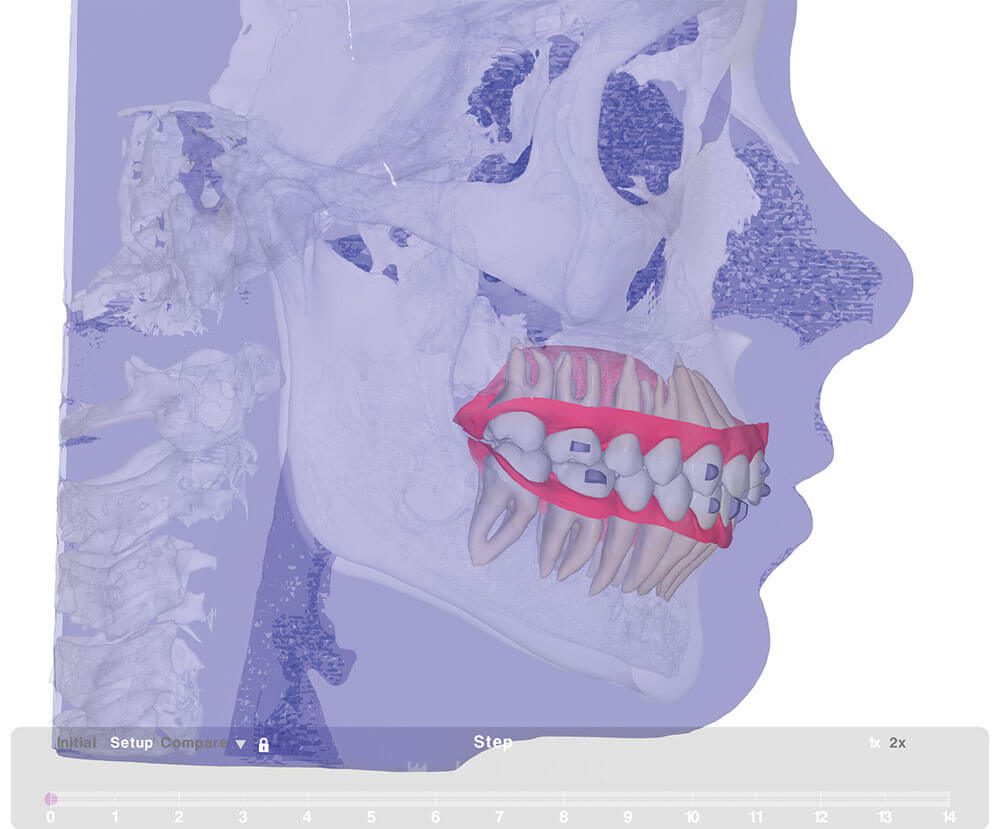 FAS Aligner System - Diagnostic elements FAS Aligner System - Diagnostic elements